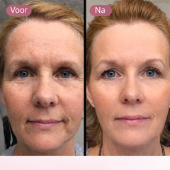 Jade Gezicht Roller & Gua Sha Steen